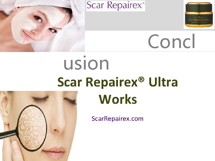 usion Concl Scar Repairex® Ultra Works Scar. Repairex. com 