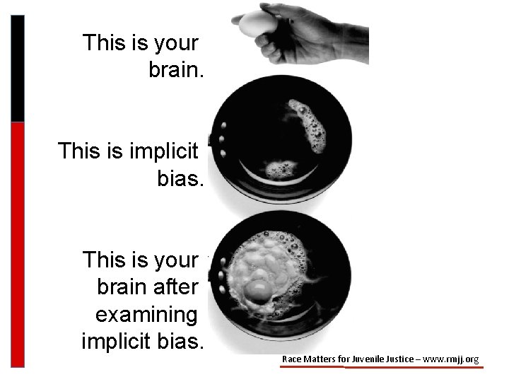 This is your brain. This is implicit bias. This is your brain after examining