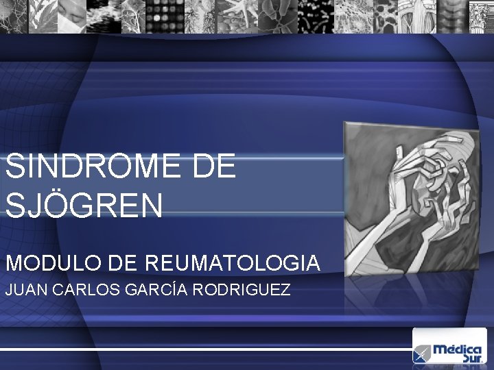 SINDROME DE SJÖGREN MODULO DE REUMATOLOGIA JUAN CARLOS GARCÍA RODRIGUEZ 