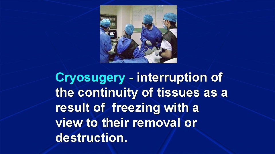 Cryosugery - interruption of the continuity of tissues as a result of freezing with
