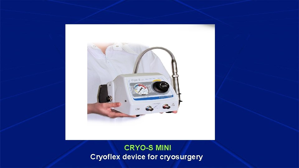 CRYO-S MINI Cryoflex device for cryosurgery 