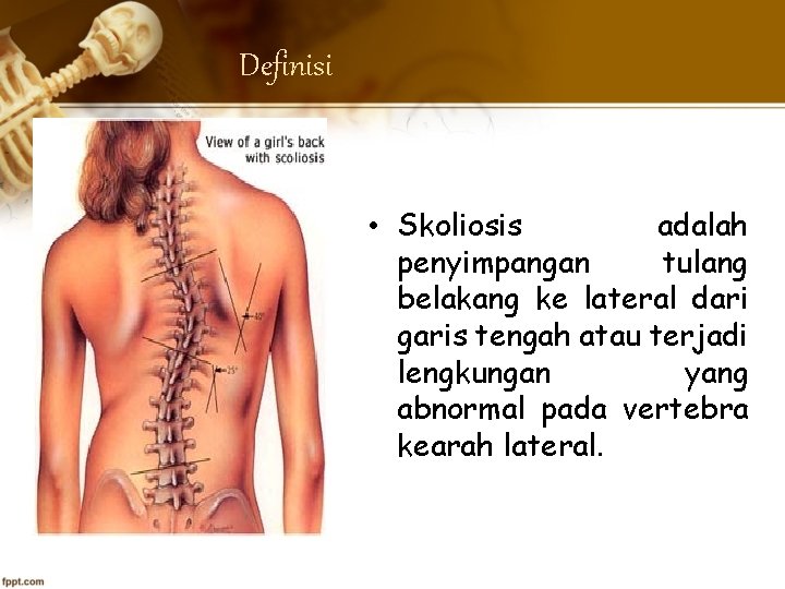 Definisi • Skoliosis adalah penyimpangan tulang belakang ke lateral dari garis tengah atau terjadi