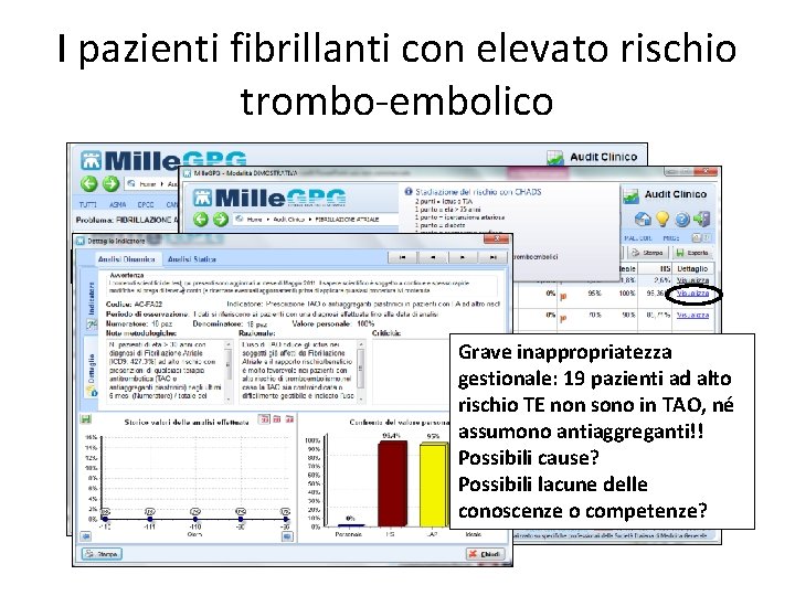 I pazienti fibrillanti con elevato rischio trombo-embolico Grave inappropriatezza gestionale: 19 pazienti ad alto