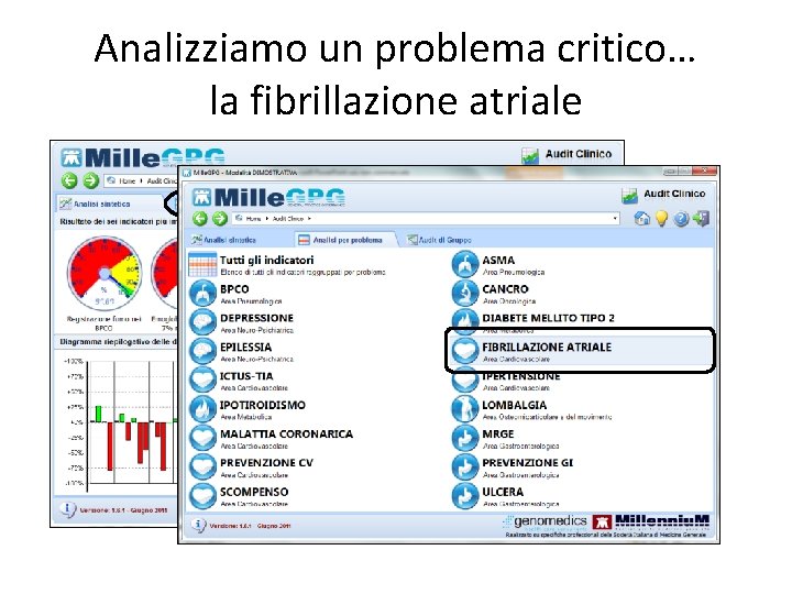 Analizziamo un problema critico… la fibrillazione atriale 