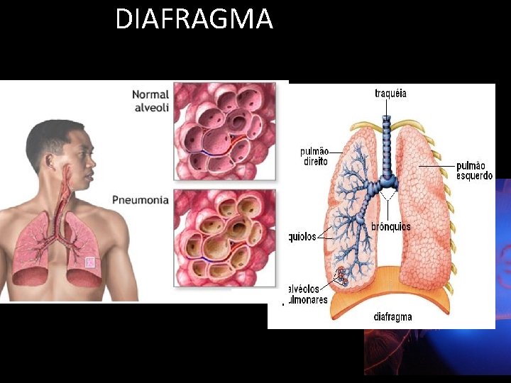 DIAFRAGMA 