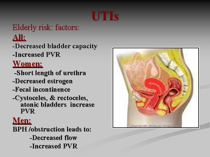 Elderly risk: factors: All: UTIs -Decreased bladder capacity -Increased PVR Women: -Short length of