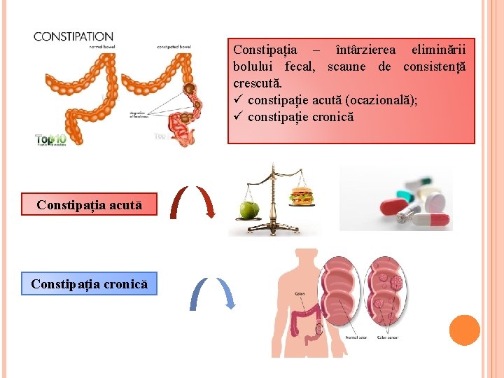 Constipația – întârzierea eliminării bolului fecal, scaune de consistență crescută. ü constipație acută (ocazională);