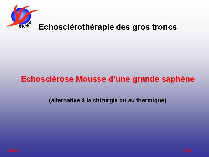 Echosclérothérapie des gros troncs Echosclérose Mousse d’une grande saphène (alternative à la chirurgie ou