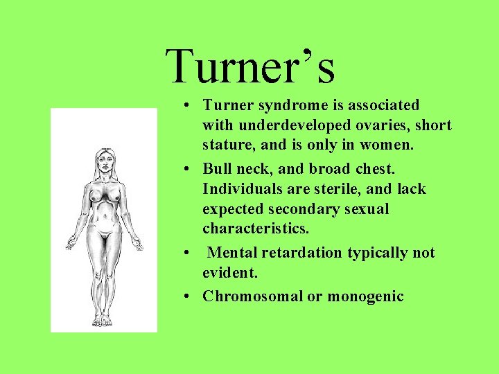 Turner’s • Turner syndrome is associated with underdeveloped ovaries, short stature, and is only