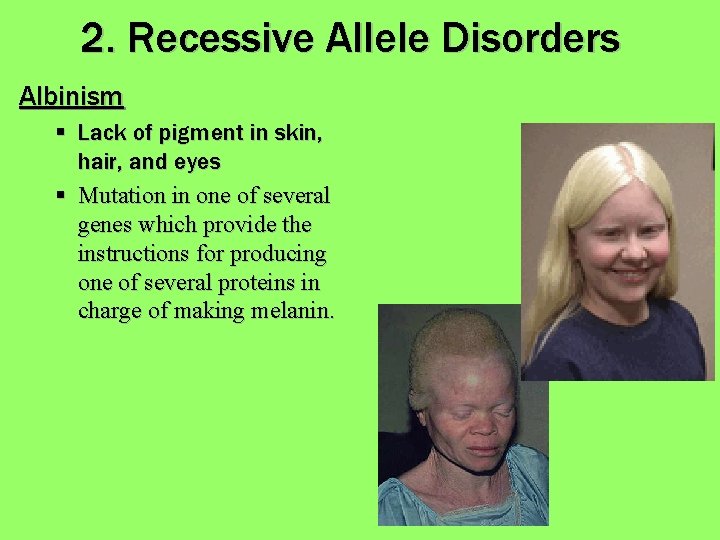 2. Recessive Allele Disorders Albinism § Lack of pigment in skin, hair, and eyes