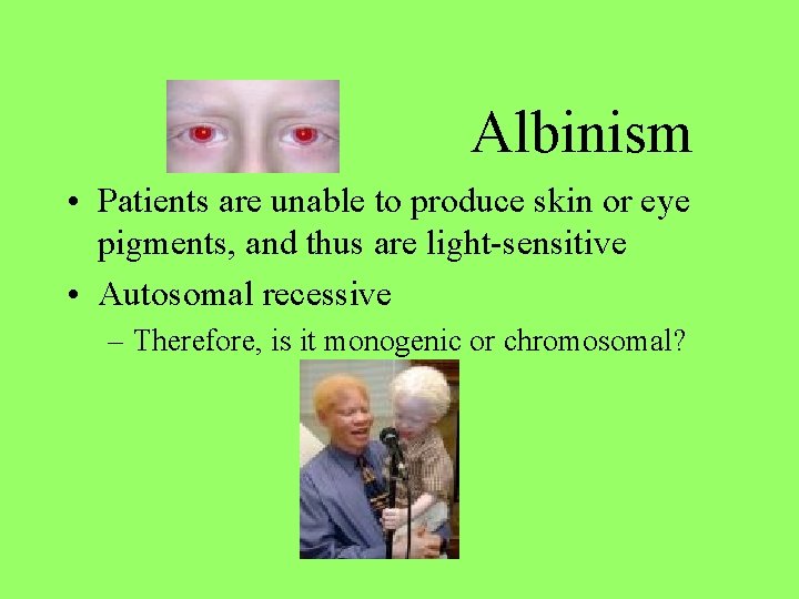 Albinism • Patients are unable to produce skin or eye pigments, and thus are