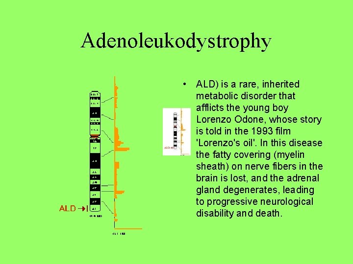 Adenoleukodystrophy • ALD) is a rare, inherited metabolic disorder that afflicts the young boy