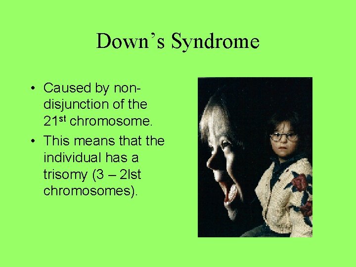 Down’s Syndrome • Caused by nondisjunction of the 21 st chromosome. • This means