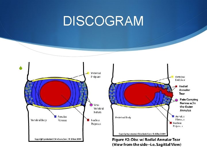 DISCOGRAM S 