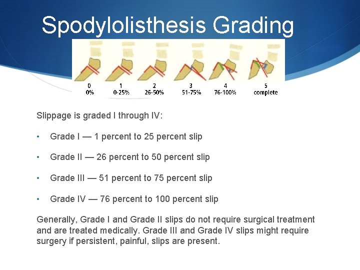 Spodylolisthesis Grading Slippage is graded I through IV: • Grade I — 1 percent