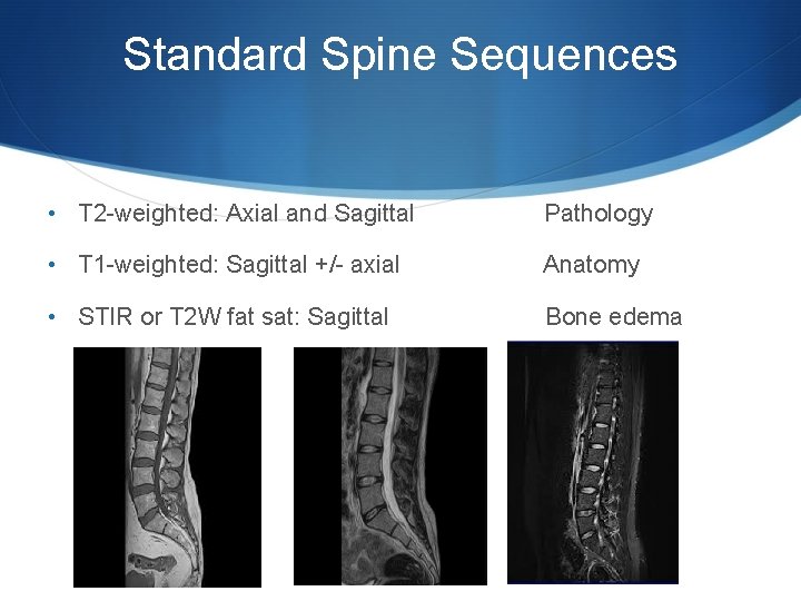 Standard Spine Sequences • T 2 -weighted: Axial and Sagittal Pathology • T 1