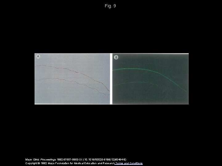 Fig. 9 Mayo Clinic Proceedings 1992 67557 -565 DOI: (10. 1016/S 0025 -6196(12)60464 -9)