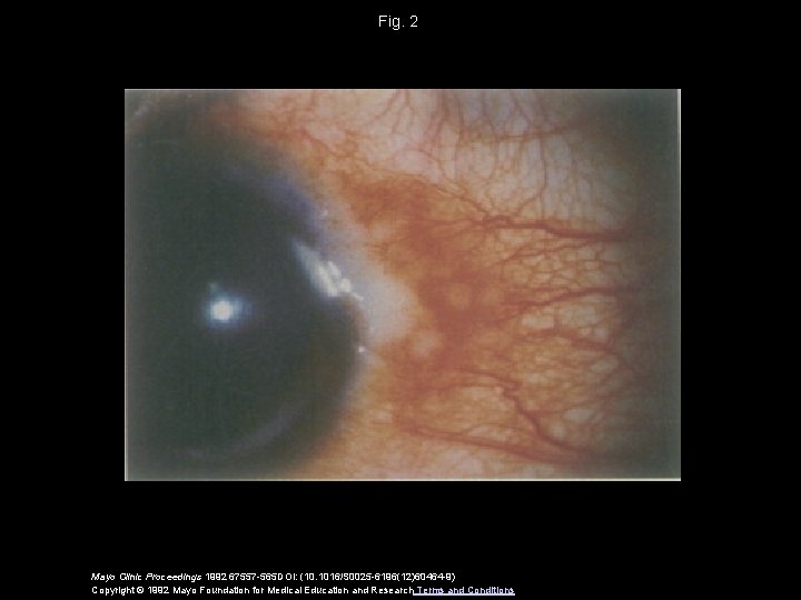 Fig. 2 Mayo Clinic Proceedings 1992 67557 -565 DOI: (10. 1016/S 0025 -6196(12)60464 -9)