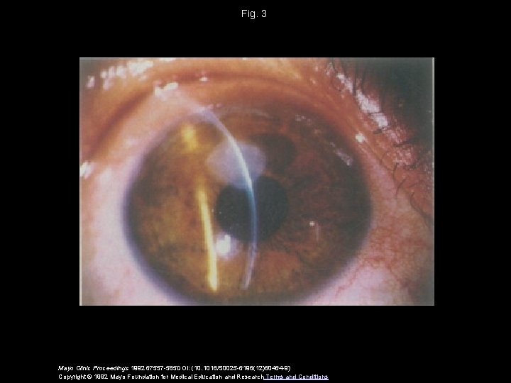 Fig. 3 Mayo Clinic Proceedings 1992 67557 -565 DOI: (10. 1016/S 0025 -6196(12)60464 -9)