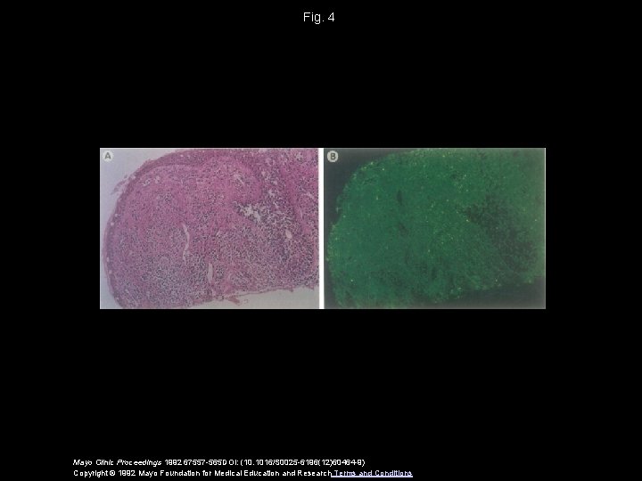 Fig. 4 Mayo Clinic Proceedings 1992 67557 -565 DOI: (10. 1016/S 0025 -6196(12)60464 -9)