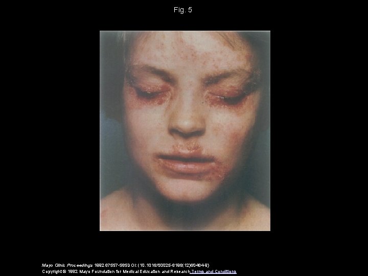 Fig. 5 Mayo Clinic Proceedings 1992 67557 -565 DOI: (10. 1016/S 0025 -6196(12)60464 -9)