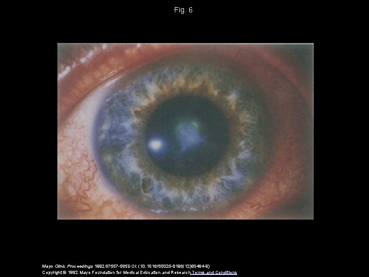 Fig. 6 Mayo Clinic Proceedings 1992 67557 -565 DOI: (10. 1016/S 0025 -6196(12)60464 -9)