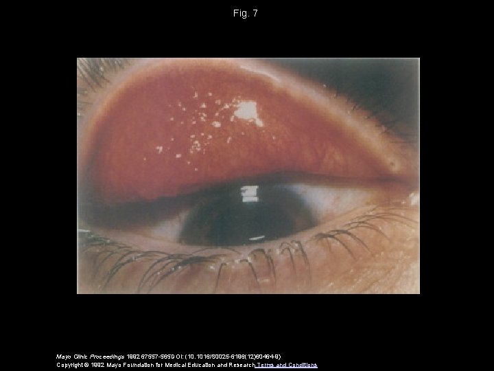 Fig. 7 Mayo Clinic Proceedings 1992 67557 -565 DOI: (10. 1016/S 0025 -6196(12)60464 -9)