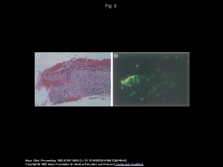 Fig. 8 Mayo Clinic Proceedings 1992 67557 -565 DOI: (10. 1016/S 0025 -6196(12)60464 -9)