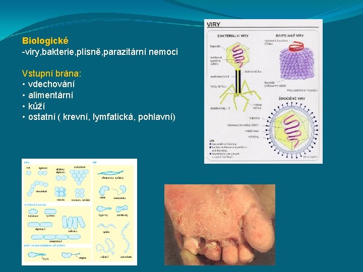 Biologické -viry, bakterie, plísně, parazitární nemoci Vstupní brána: • vdechování • alimentární • kůží