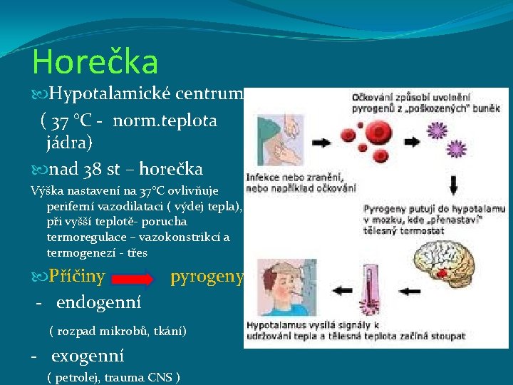 Horečka Hypotalamické centrum ( 37 °C - norm. teplota jádra) nad 38 st –