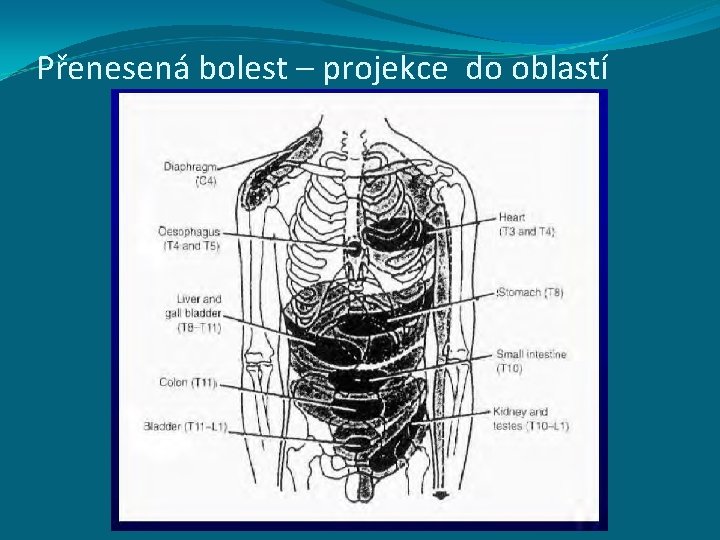 Přenesená bolest – projekce do oblastí 