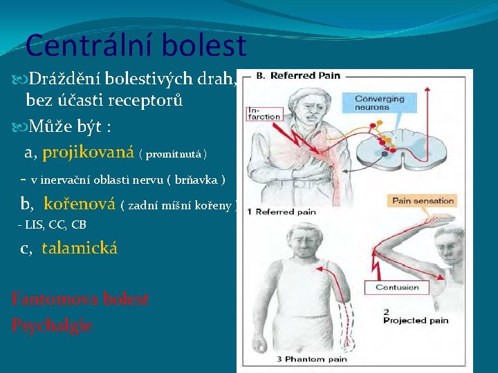 Centrální bolest Dráždění bolestivých drah, bez účasti receptorů Může být : a, projikovaná (