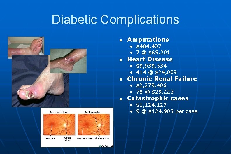 Diabetic Complications n Amputations • $484, 407 • 7 @ $69, 201 n Heart