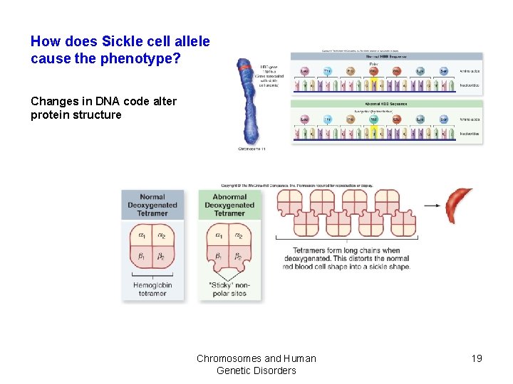 How does Sickle cell allele cause the phenotype? Changes in DNA code alter protein