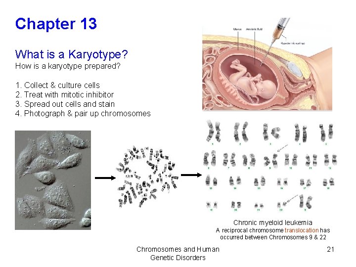 Chapter 13 What is a Karyotype? How is a karyotype prepared? 1. Collect &