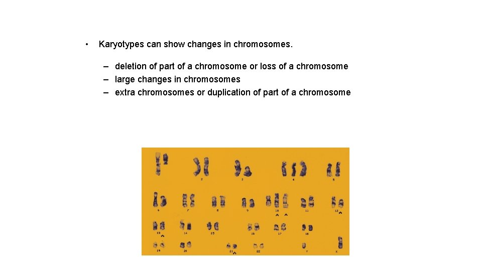 • Karyotypes can show changes in chromosomes. – deletion of part of a • Karyotypes can show changes in chromosomes. – deletion of part of a