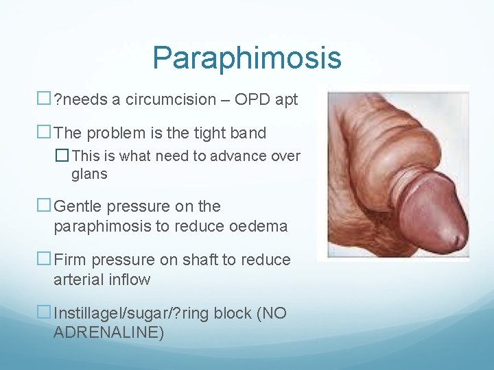 Paraphimosis �? needs a circumcision – OPD apt �The problem is the tight band
