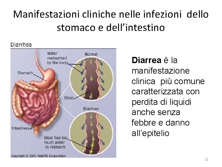 Manifestazioni cliniche nelle infezioni dello stomaco e dell’intestino Diarrea è la manifestazione clinica più Manifestazioni cliniche nelle infezioni dello stomaco e dell’intestino Diarrea è la manifestazione clinica più