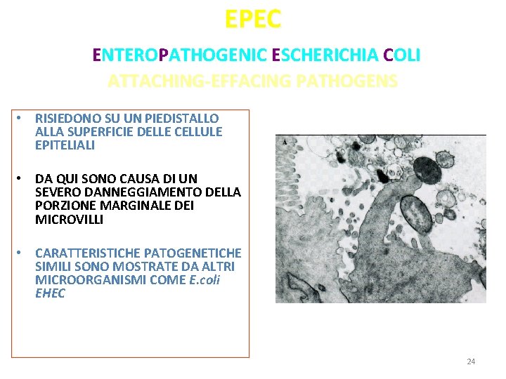 EPEC ENTEROPATHOGENIC ESCHERICHIA COLI ATTACHING-EFFACING PATHOGENS • RISIEDONO SU UN PIEDISTALLO ALLA SUPERFICIE DELLE EPEC ENTEROPATHOGENIC ESCHERICHIA COLI ATTACHING-EFFACING PATHOGENS • RISIEDONO SU UN PIEDISTALLO ALLA SUPERFICIE DELLE