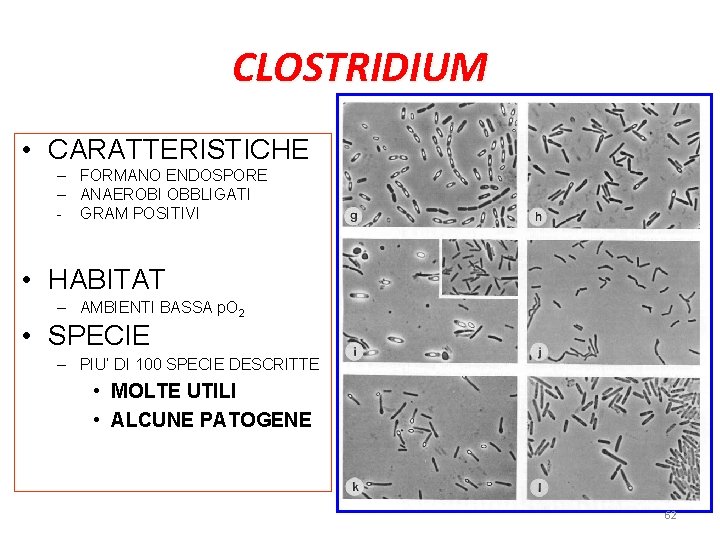 CLOSTRIDIUM • CARATTERISTICHE – FORMANO ENDOSPORE – ANAEROBI OBBLIGATI - GRAM POSITIVI • HABITAT CLOSTRIDIUM • CARATTERISTICHE – FORMANO ENDOSPORE – ANAEROBI OBBLIGATI - GRAM POSITIVI • HABITAT