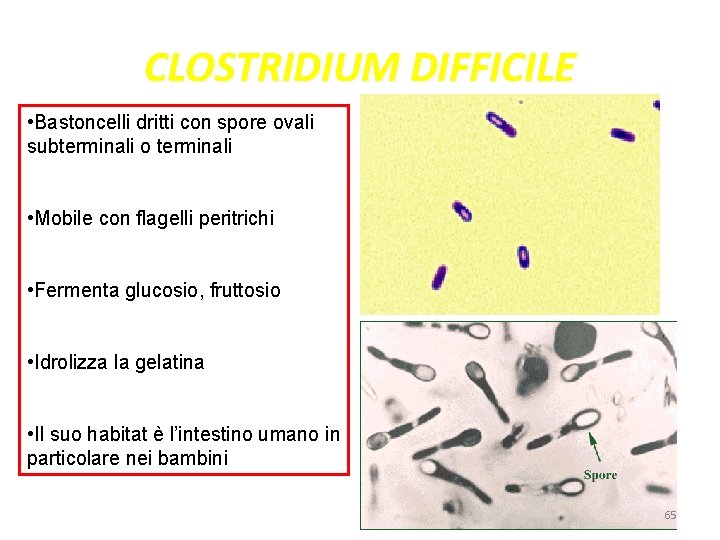 CLOSTRIDIUM DIFFICILE • Bastoncelli dritti con spore ovali subterminali o terminali • Mobile con CLOSTRIDIUM DIFFICILE • Bastoncelli dritti con spore ovali subterminali o terminali • Mobile con