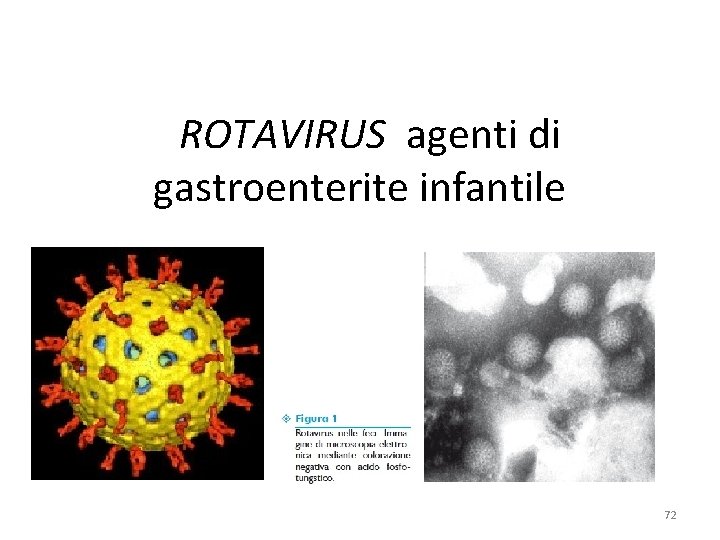 ROTAVIRUS agenti di gastroenterite infantile 72 ROTAVIRUS agenti di gastroenterite infantile 72