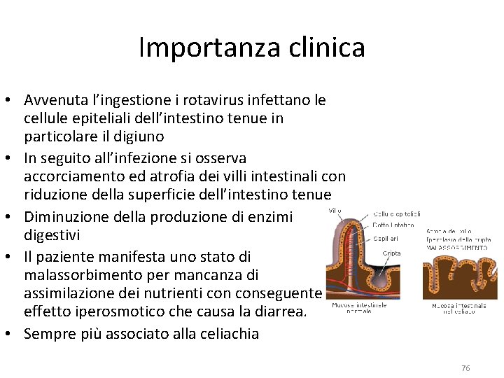 Importanza clinica • Avvenuta l’ingestione i rotavirus infettano le cellule epiteliali dell’intestino tenue in Importanza clinica • Avvenuta l’ingestione i rotavirus infettano le cellule epiteliali dell’intestino tenue in