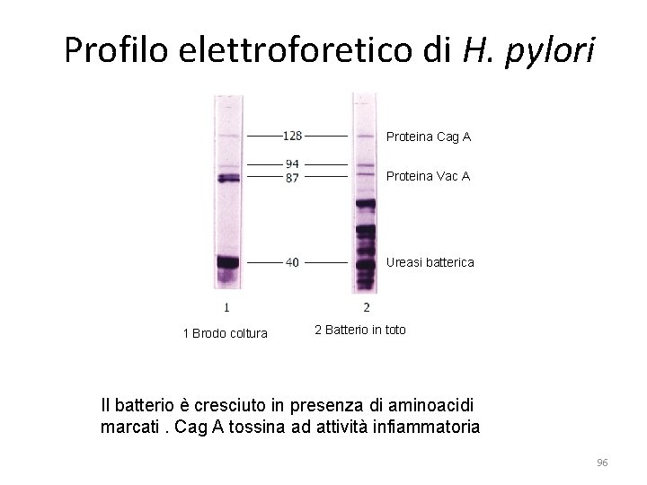 Profilo elettroforetico di H. pylori Proteina Cag A Proteina Vac A Ureasi batterica 1 Profilo elettroforetico di H. pylori Proteina Cag A Proteina Vac A Ureasi batterica 1