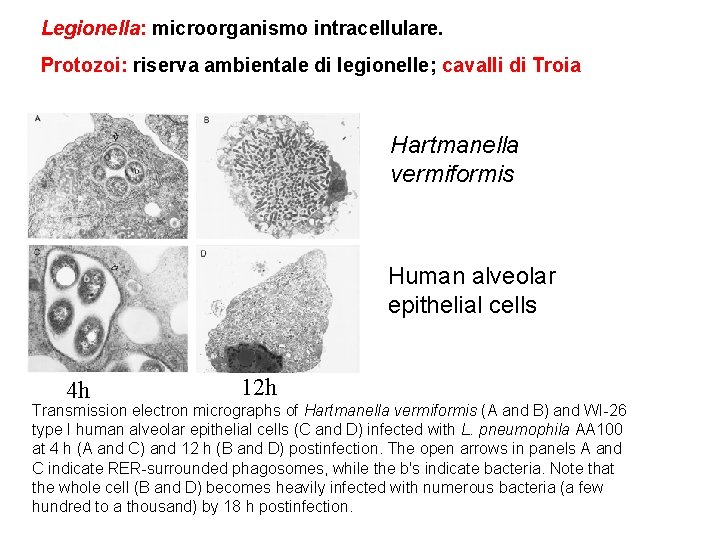 Legionella: microorganismo intracellulare. Protozoi: riserva ambientale di legionelle; cavalli di Troia Hartmanella vermiformis Human