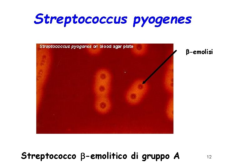  Streptococcus pyogenes -emolisi Streptococco -emolitico di gruppo A 12 