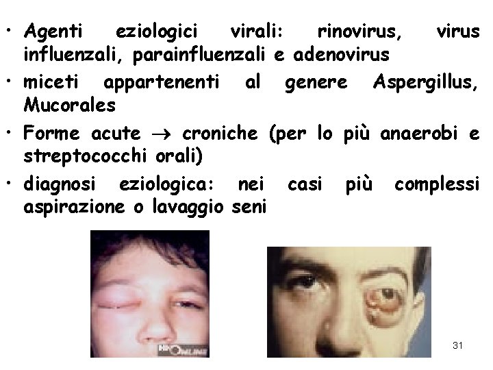  • Agenti eziologici virali: rinovirus, virus influenzali, parainfluenzali e adenovirus • miceti appartenenti