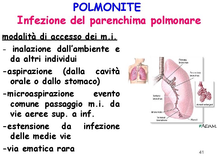POLMONITE Infezione del parenchima polmonare modalità di accesso dei m. i. - inalazione dall’ambiente