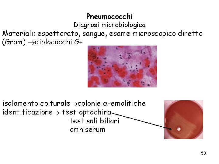 Pneumococchi Diagnosi microbiologica Materiali: espettorato, sangue, esame microscopico diretto (Gram) diplococchi G+ isolamento colturale