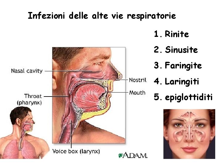 Infezioni delle alte vie respiratorie 1. Rinite 2. Sinusite 3. Faringite 4. Laringiti 5.